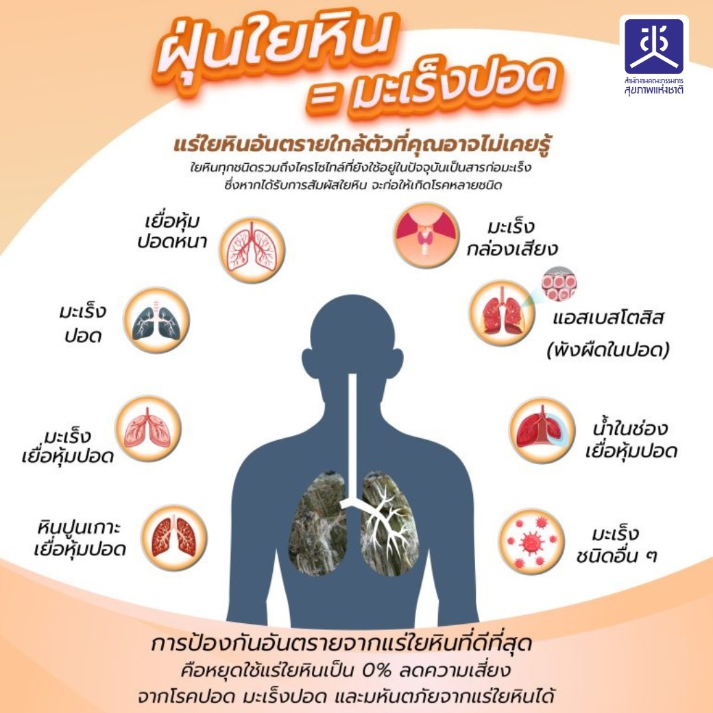 มะเร็งปอด อีกหนึ่งสาเหตุมาจาก แร่ใยหิน!! มหันตภัย “แร่ใยหิน” คร่าชีวิตได้อย่างคิดไม่ถึง แร่ใยหินอันตรายใกล้ตัวที่คุณอาจไม่เคยรู้